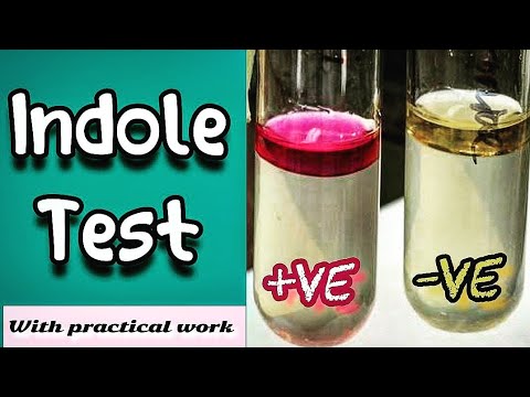 Indole test - Microbiology (Microbial Biochemical test)