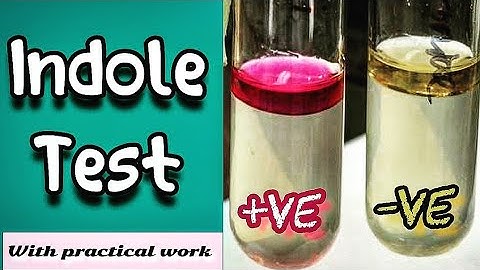 Indole test - Microbiology (Microbial Biochemical test)