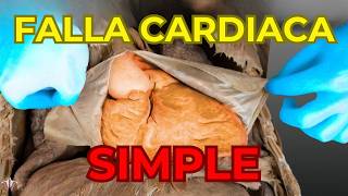 Cómo empieza a FALLAR el corazón: lentamente