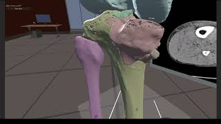 VR for DICOM data