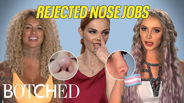 Dr. Nassif Rejected These Nose Jobs: Gender Transition, Freak Accidents and More! | Botched | E!