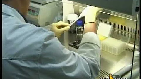 Dove fare il test HIV a Torino?