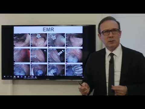 Video: Polyp Av Sigmoid Kolon: Symptom, Behandling, Borttagning, Orsaker