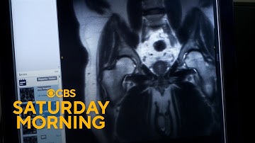 Mt. Sinai medical school embraces AI education platform