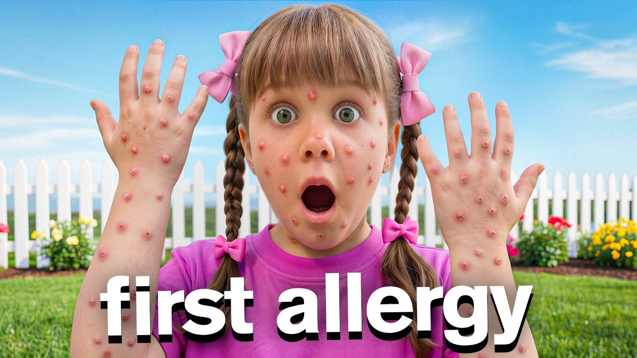 Allergic Reaction on Vacation