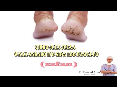 Afrika jinsiy aloqasini onlayn tomosha qiling Yigitni erkaklar sikishadi