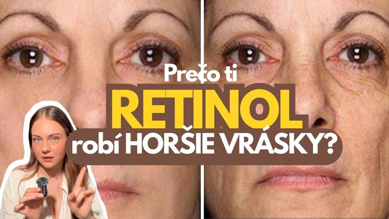 PRAVDA O RETINOLE. Používaš ho celý čas zle?   #retinol #skincare #antiaging