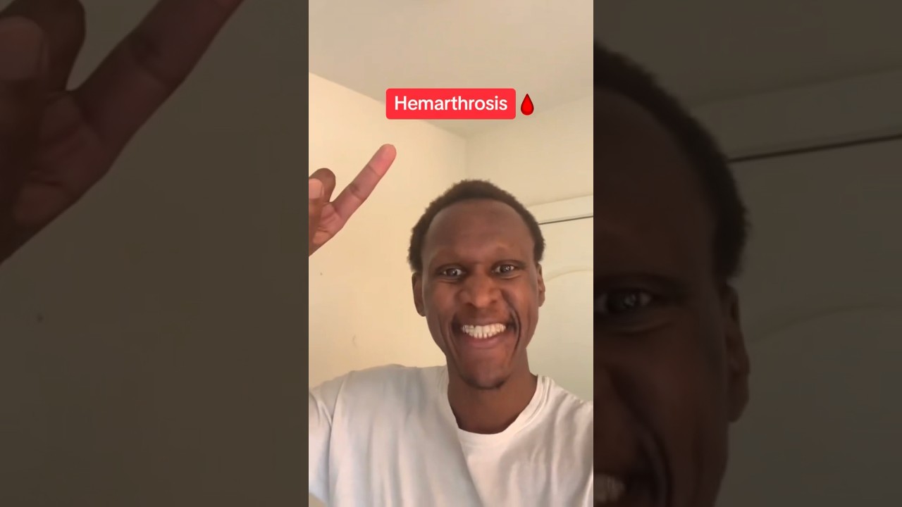 Hemarthrosis 🩸