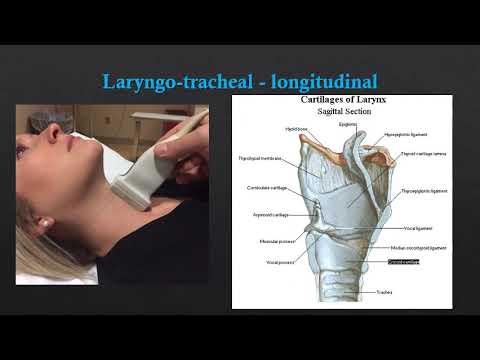 neck diagrams alternative neck diagrams alternative