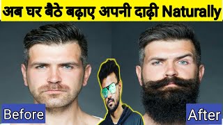 जल्दी दाढ़ी बढाने का उपाय  | teji se Beard badhane ke upay | दाढ़ी उगाने का घरेलु उपाय | आंवला का तेल