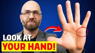 SICK HEART 5 Signs on Your Hands That May Reveal Heart Problems