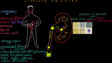 C'est quoi la lithiase ?