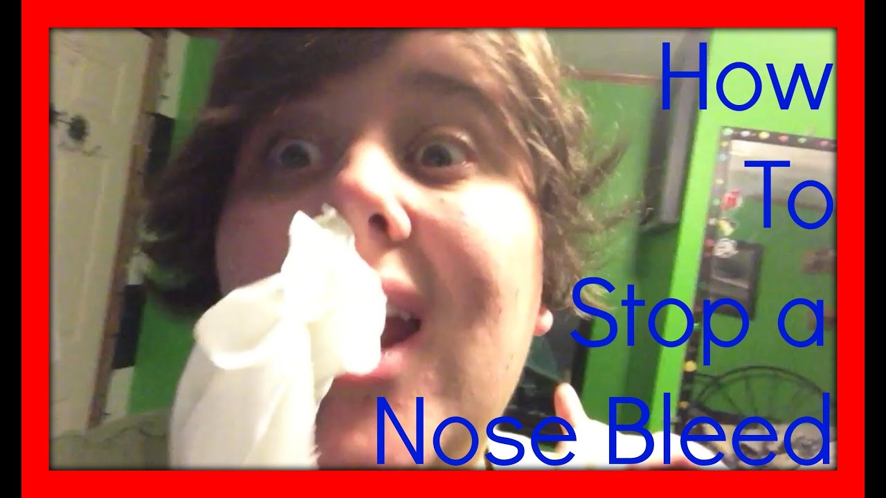 HOW TO STOP A NOSE BLEED YouTube