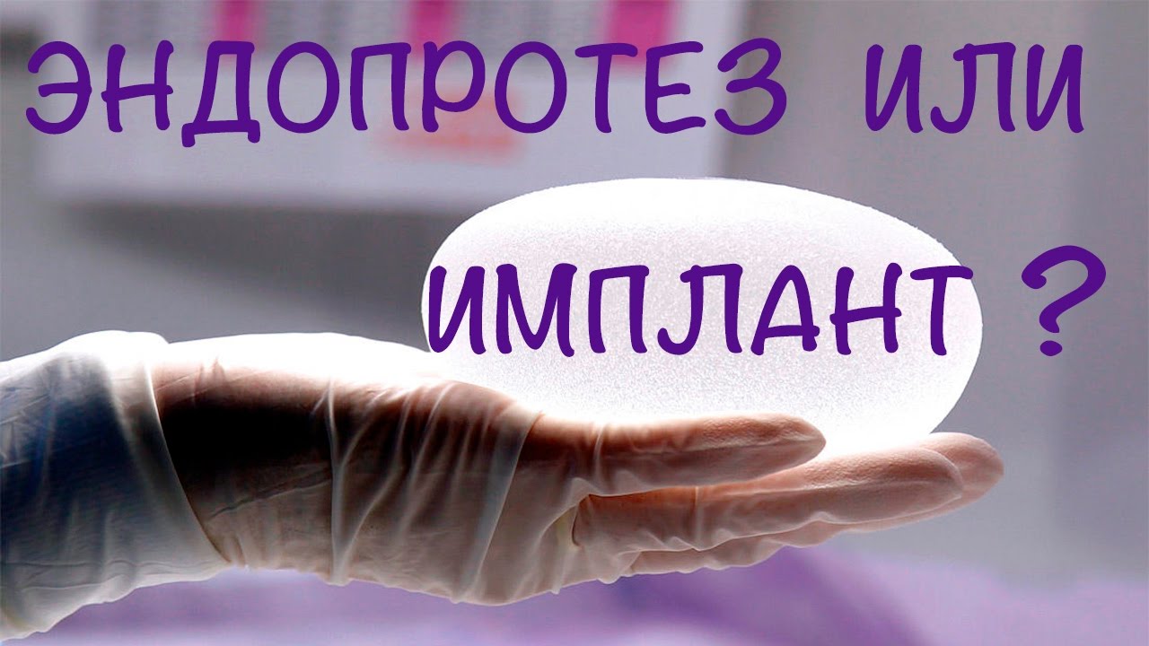 Имплант или эндопротез? Как правильно? - YouTube