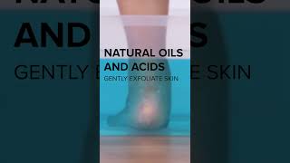 Remove Dead Skin On Your Feet Easily With This Hack