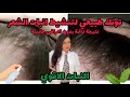 اقوي تونك طبيعي لتنشيط انبات الشعر فوائد النعناع الطبيعي الجبارة Lلشعر فرح محسن Drjoy 