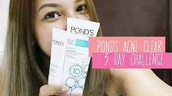 My Pond's 3 Day Acne Clear Challenge