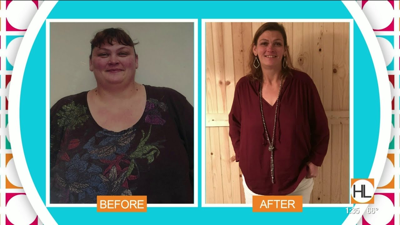 How to eat healthy after weight loss surgery HOUSTON LIFE KPRC 2