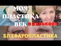 БЛЕФАРОПЛАСТИКА верхних век! До и после. #пластикавек# #blepharoplasty#