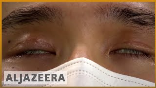 Changing faces China s plastic surgery boom Al Jazeera English