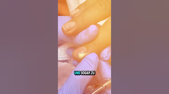 🚫 Stop pulling on torn cuticles! #health #facts #bonecracker