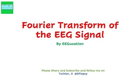 Fast Fourier Transform of the EEG Signal