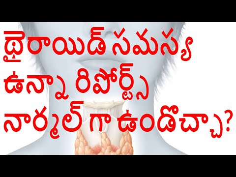 థైరాయిడ్-సమస్య-ఉన్నా-రిపోర్ట్స్-నార్మల్-గా-ఉండొచ్చా?-severe-hypothyroidism-but-normal-blood-reports?