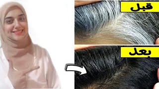 افضل فيتامين و شامبو ووصفة طبيعية لازالة الشعر الابيض نهائيا/ تخلص من الشيب قبل ان يملئ الرأس screenshot 1