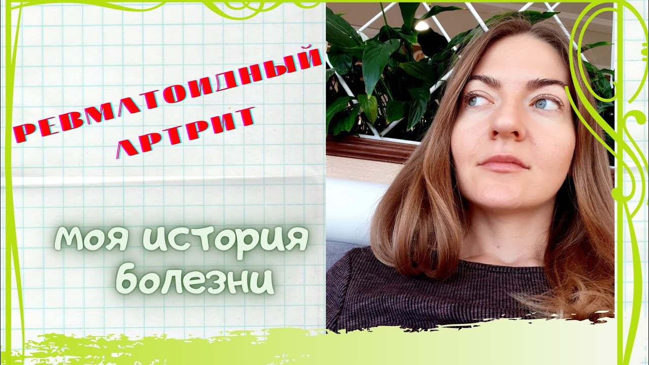 Ревматоидный артрит. Моя история и лечение артрита. - YouTube