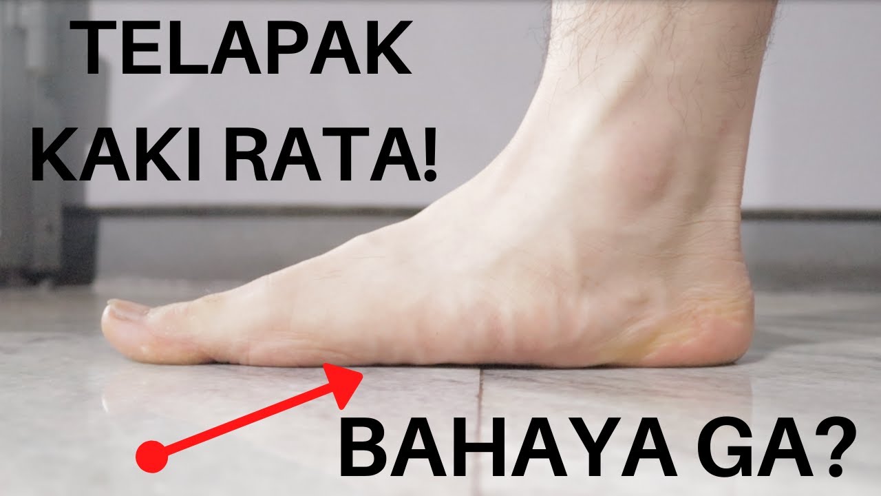 Kaki rata tapak lactolite: Sakit