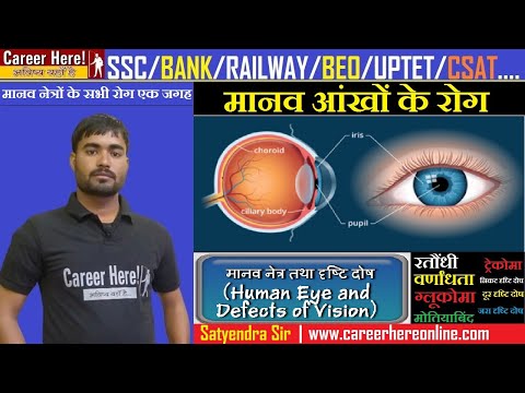 Disease of Human Eye | Defects of Vision | निकट दृष्टि दोष | दूर दृष्टि दोष | रतौंधी |वर्णांधता