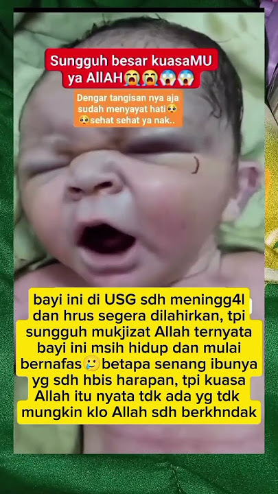 kalo Allah sdh berkehendak tdk ada yg tdk mungkin 🥲 #fypviral #trendingshorts