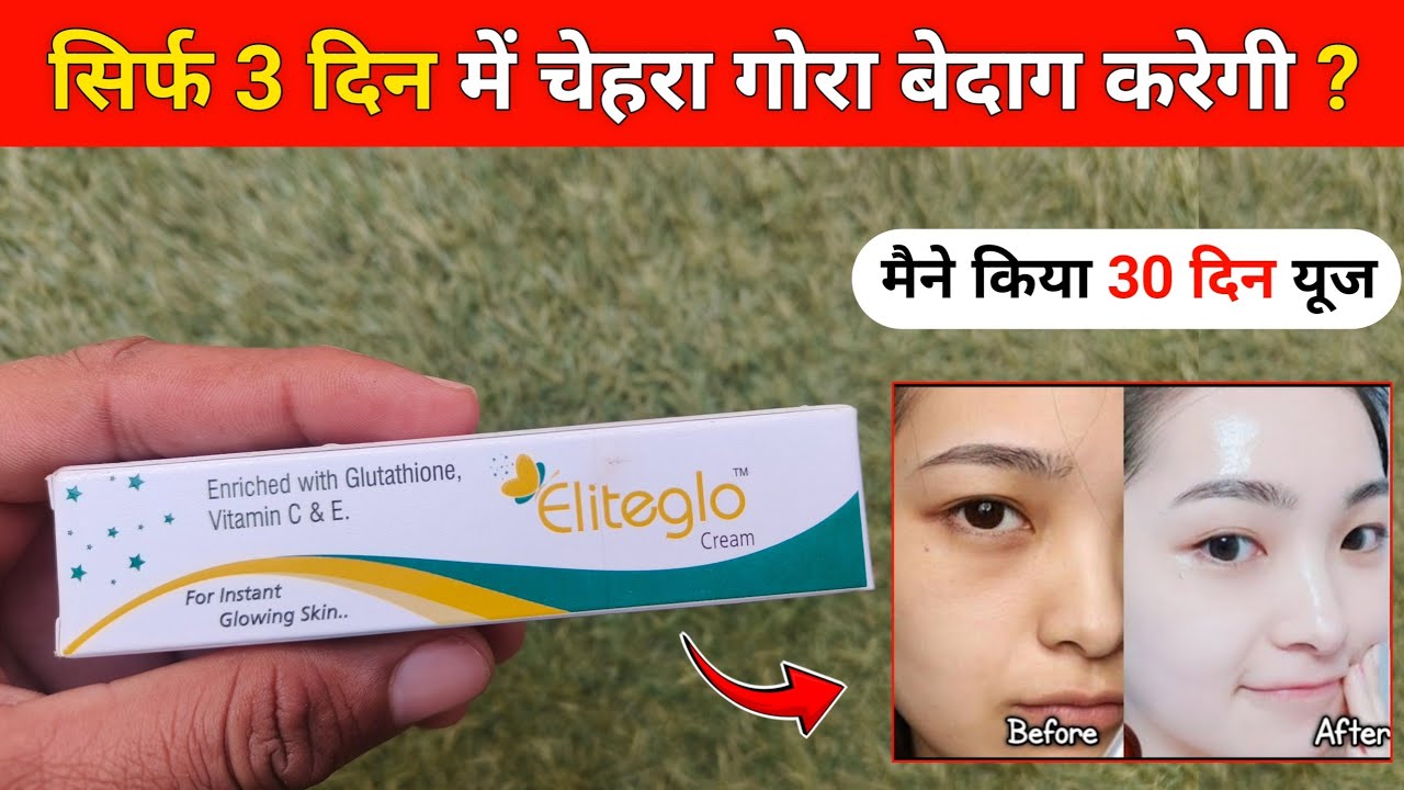 Eliteglo cream review | eliteglo cream use kaise kare | eliteglo cream 
