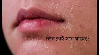 MANY PROBLEM ONE SOLUTION TENDER CARE||ORIFLAME TENDER CARE|| #oriflameindia screenshot 4