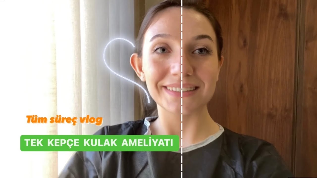 TEK KEPÇE KULAK AMELİYAT SÜRECİM | Fiyat, Doktor, Hastane bilgisi, Ameliyat sonrasındaki süreçler