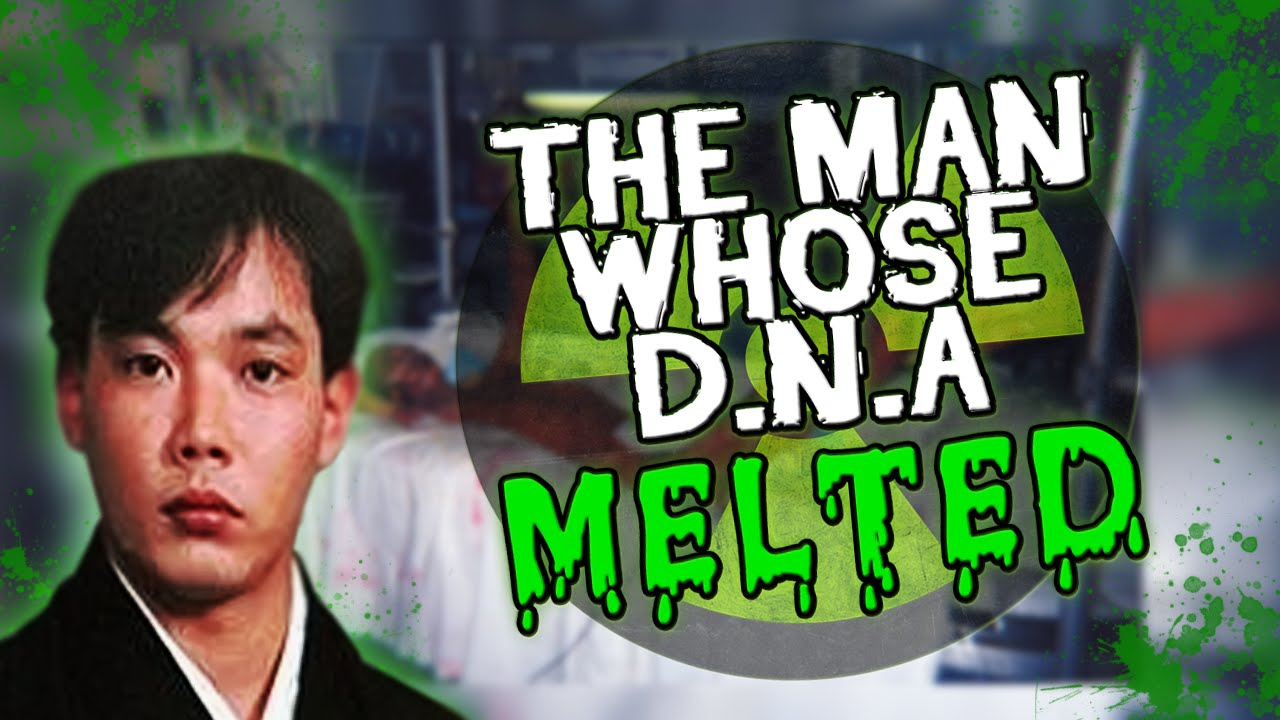 The Man Whose D.N.A MELTED!