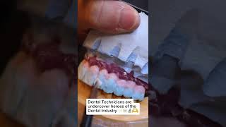 Dental Technician working on a brand new smile 🦷✨#dentallaboratorytechnician