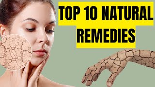 The Ultimate Top 10 Natural Remedies for Dry Skin, How To Keep Skin Moisturize!