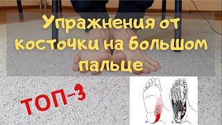 Упражнения от косточки на пальце ноги(Hallux Valgus/Вальгус)