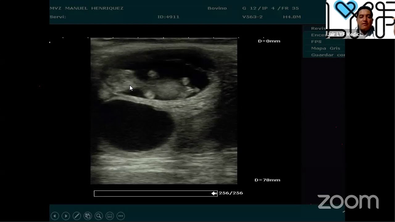 BASES DE LA ECOGRAFÍA APLICADA A LA REPRODUCCIÓN BOVINA. MVZ. JAIR SILVA DE LA ROSA. LYF MEDICAL