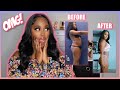 My Smart Lipo Journey | Part One | Sonobello