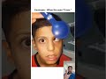 99% Fail - ESOTROPIA - When the EYES CROSS 😱 #funny #memes #shorts