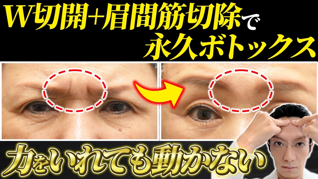 Comparable to a full face lift!?] Explaining the rejuvenating
