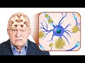 Genetically at Risk for Alzheimer&#39;s Disease? DO THIS...