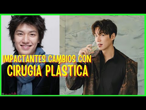 Video: Actores coreanos antes y después de la cirugía plástica. ¿Cuál de los actores coreanos se hizo cirugía plástica?