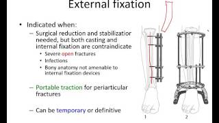 Orthopaedic trauma for med students 2