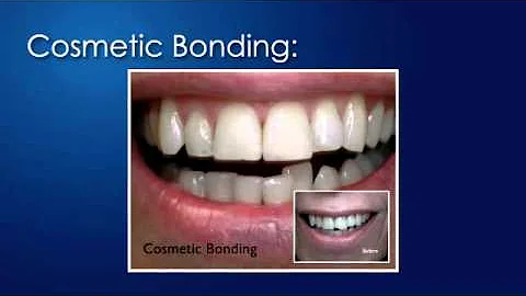 Velma Cooper, DMD, PA on How to Make Your Smile Lo...