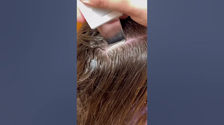 Scalp Treatment for Dandruff/Buildup - DayDayNews