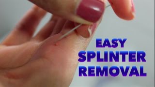 Draw Out A Splinter From Skin - Drawing Video