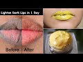 Lighten Dark Lips in 1 Day & Get Baby Soft Lips & Pink Lips - Lip mask for Dry Lips & Chapped Lips